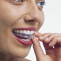 Invisalign