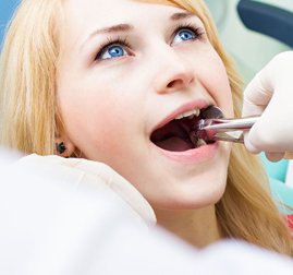 Quand faut-il avoir recours à des extractions dentaires ? - CISCO