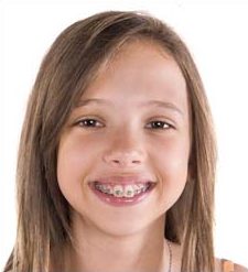 enfant et orthodontiste