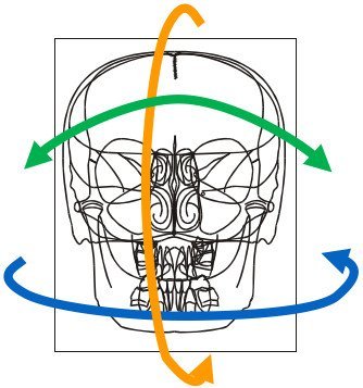 Téléradiographie de face 02