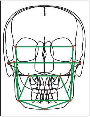 Téléradiographie de face 05