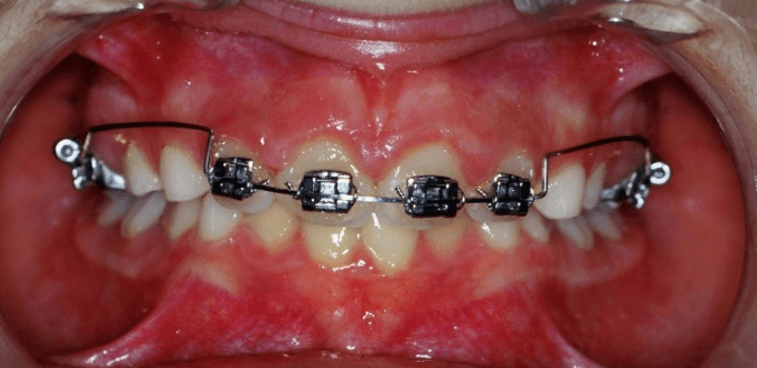 21-dents-+-arc