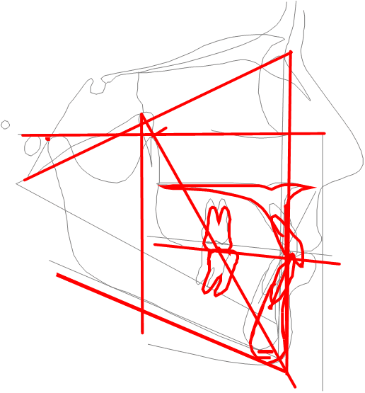 30-Tracé-schema