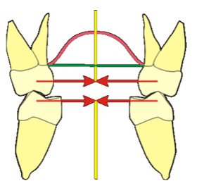 6-dents