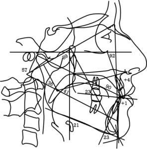 65-tracé