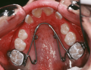 7-dents-2