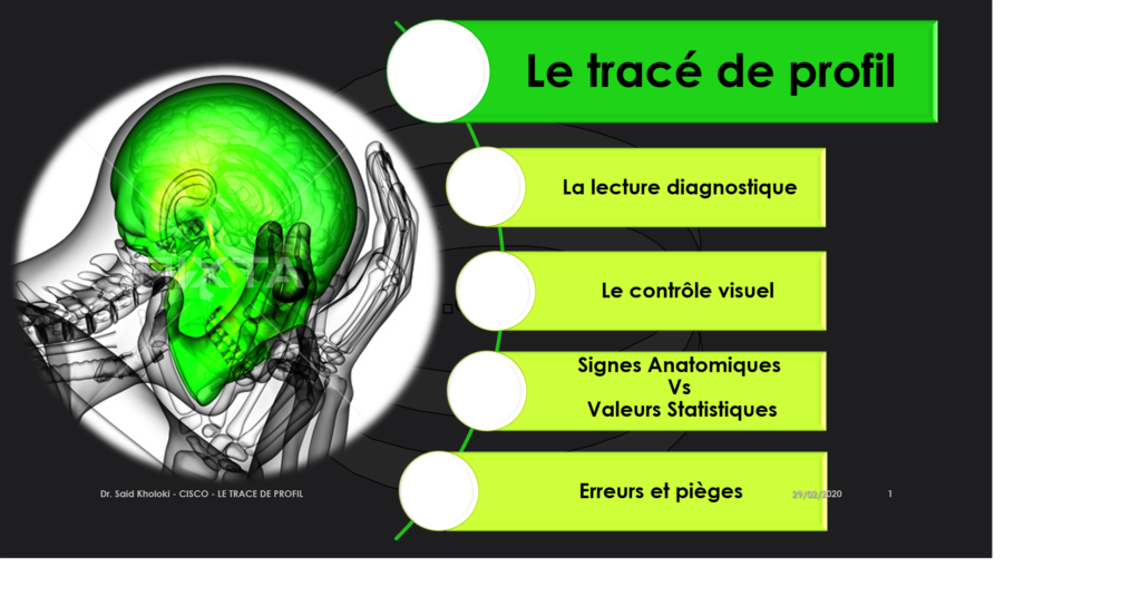 Trace de profil plan 1