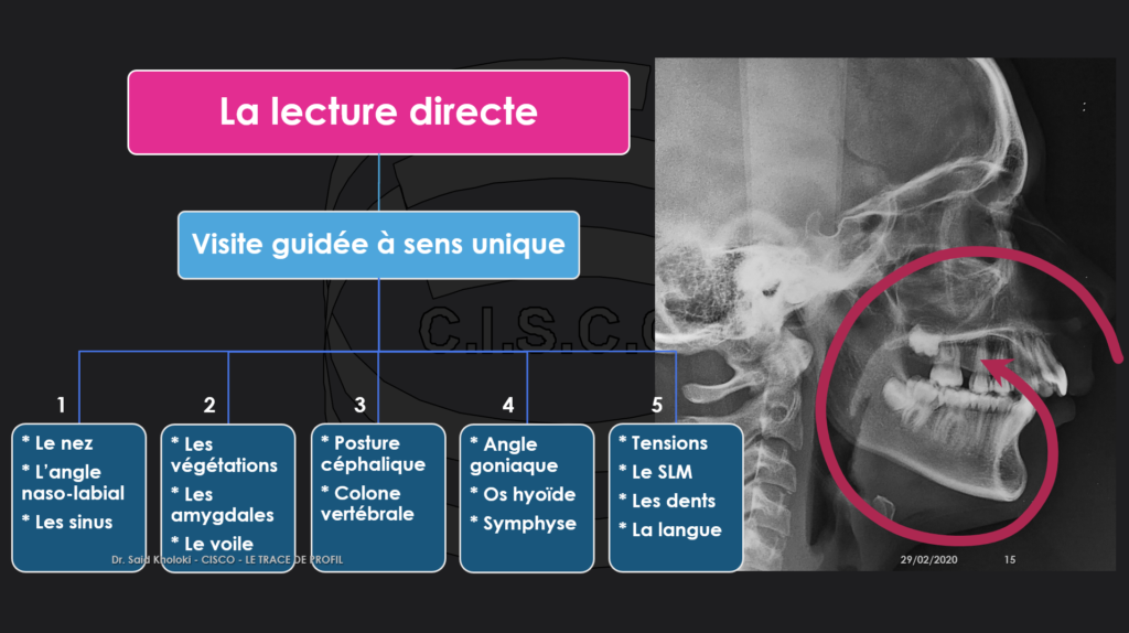 Trace de profil plan 2