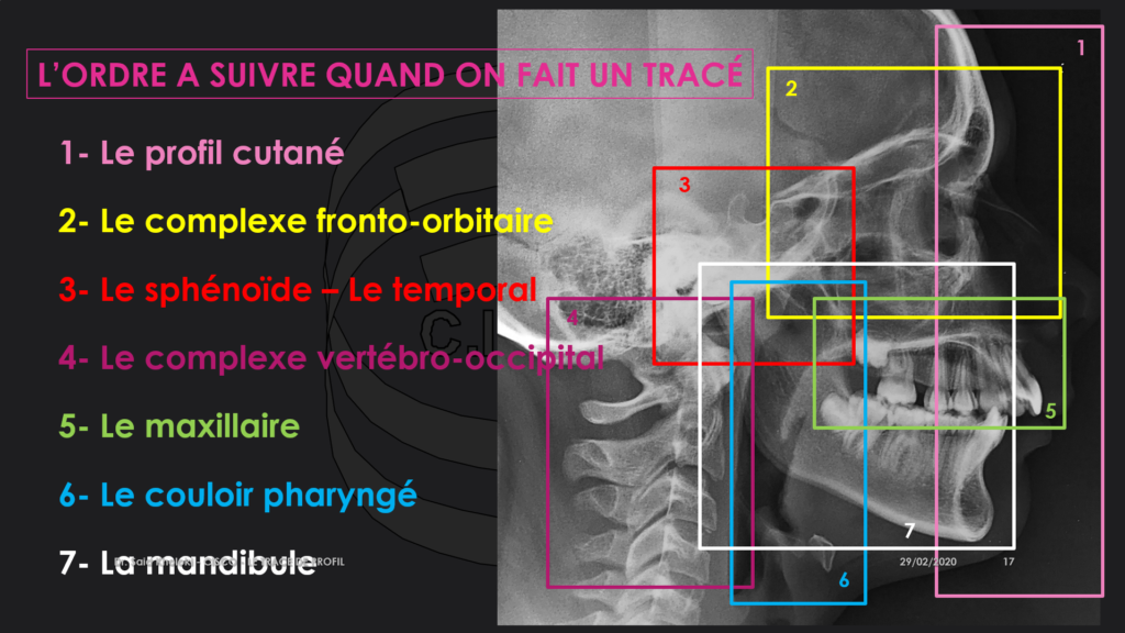 Trace de profil plan 3