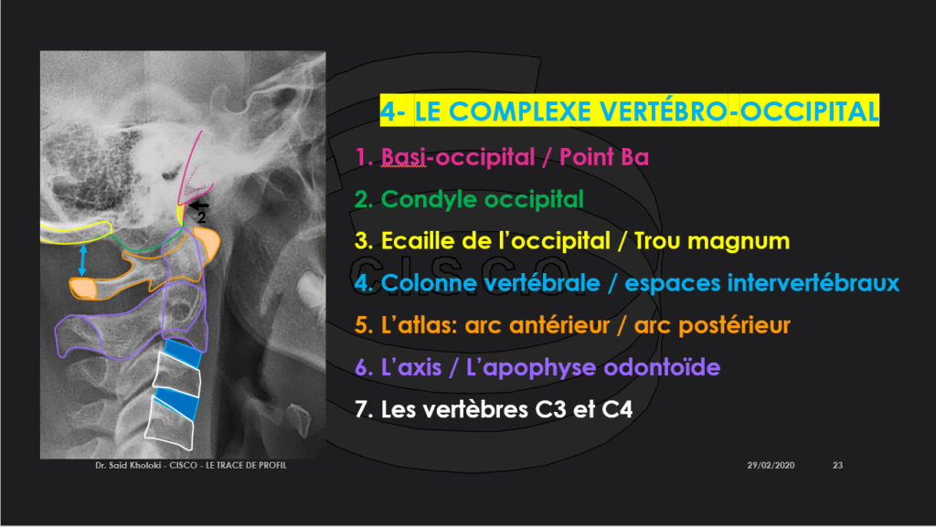 Trace de profil plan 4