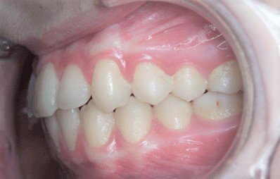 Objectifs de la formation d'orthodontiste - CISCO - Formation en