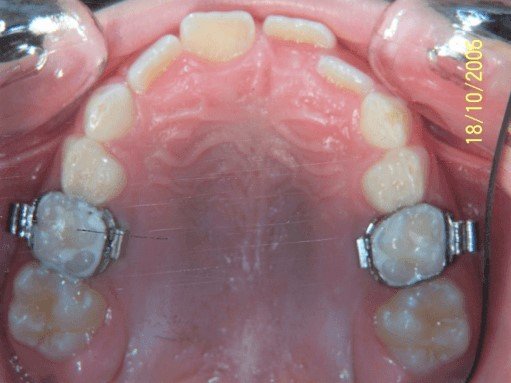 Objectifs de la formation d'orthodontiste - CISCO - Formation en